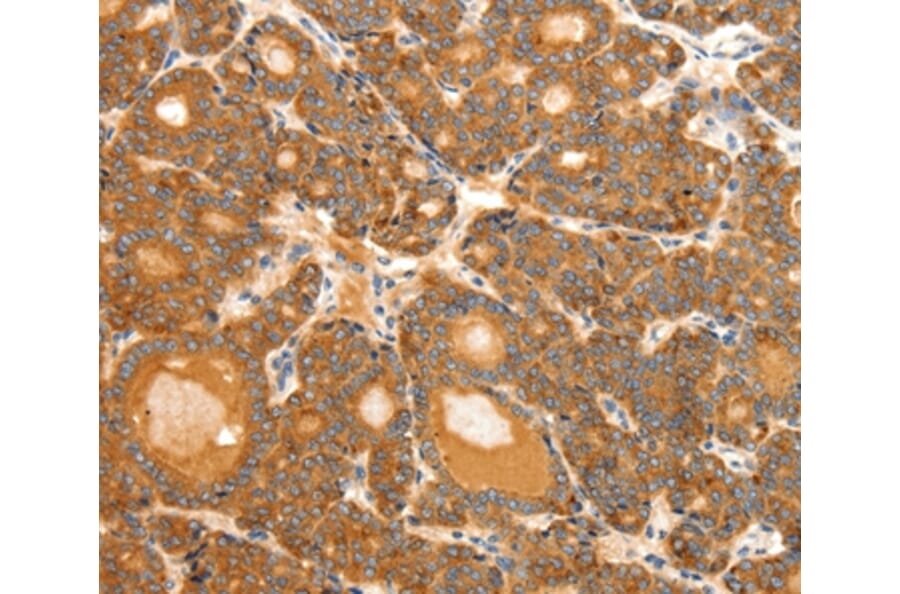 Immunohistochemistry - SCT Antibody from Signalway Antibody (37237) - Antibodies.com