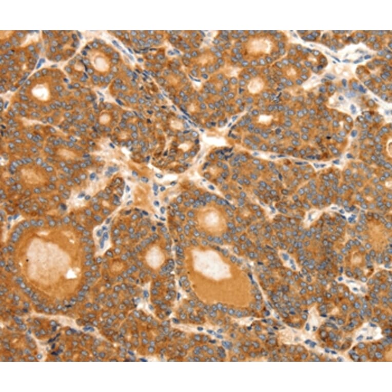 Immunohistochemistry - SCT Antibody from Signalway Antibody (37237) - Antibodies.com
