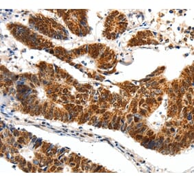 Immunohistochemistry - SP1 Antibody from Signalway Antibody (37251) - Antibodies.com