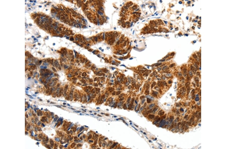 Immunohistochemistry - SP1 Antibody from Signalway Antibody (37251) - Antibodies.com