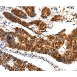 Immunohistochemistry - SP1 Antibody from Signalway Antibody (37251) - Antibodies.com