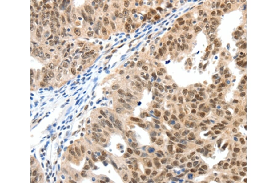 Immunohistochemistry - SP1 Antibody from Signalway Antibody (37251) - Antibodies.com