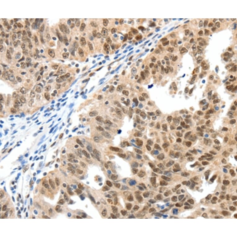 Immunohistochemistry - SP1 Antibody from Signalway Antibody (37251) - Antibodies.com