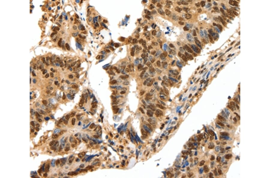 Immunohistochemistry - SSB Antibody from Signalway Antibody (37254) - Antibodies.com