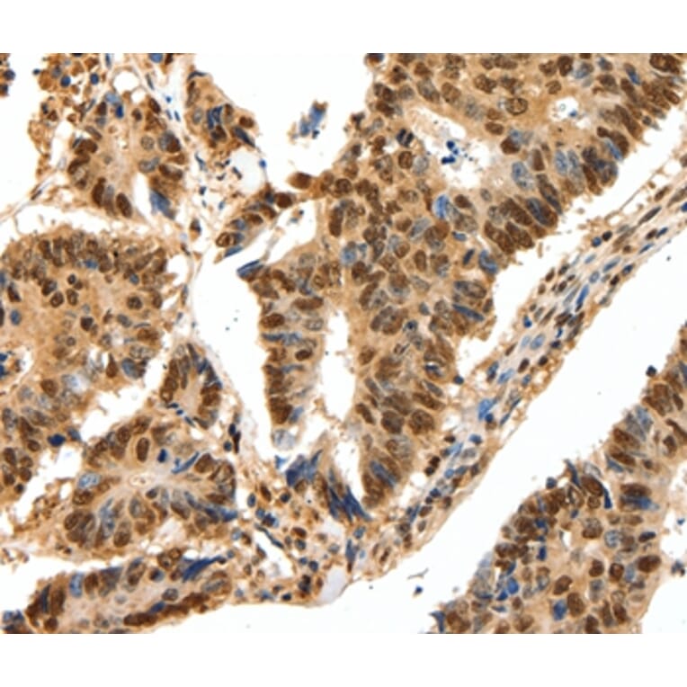 Immunohistochemistry - SSB Antibody from Signalway Antibody (37254) - Antibodies.com