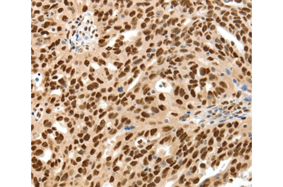 Immunohistochemistry - SSB Antibody from Signalway Antibody (37254) - Antibodies.com