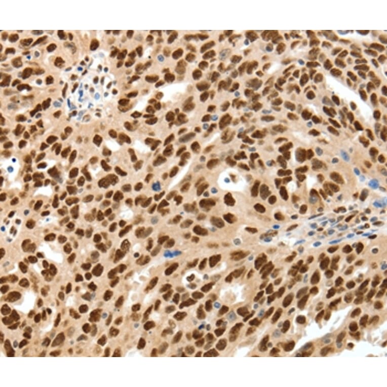 Immunohistochemistry - SSB Antibody from Signalway Antibody (37254) - Antibodies.com