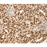 Immunohistochemistry - SSB Antibody from Signalway Antibody (37254) - Antibodies.com