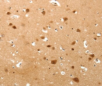 Immunohistochemical analysis of paraffin-embedded Human brain tissue using #37267 at dilution 1/40.