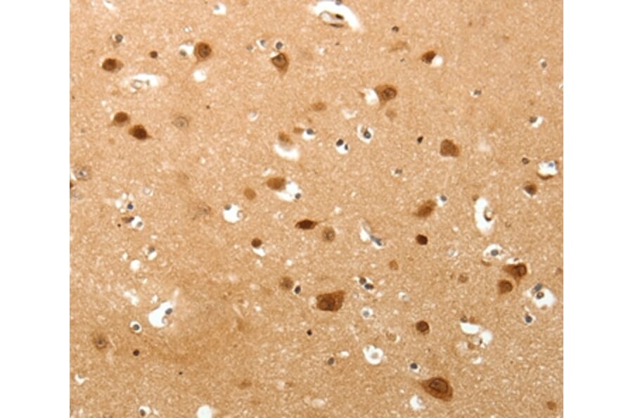 Immunohistochemistry - TNN Antibody from Signalway Antibody (37267) - Antibodies.com