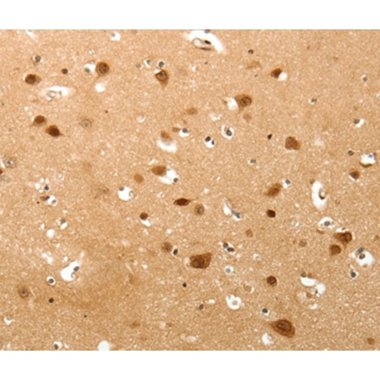 Immunohistochemistry - TNN Antibody from Signalway Antibody (37267) - Antibodies.com