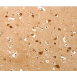 Immunohistochemistry - TNN Antibody from Signalway Antibody (37267) - Antibodies.com