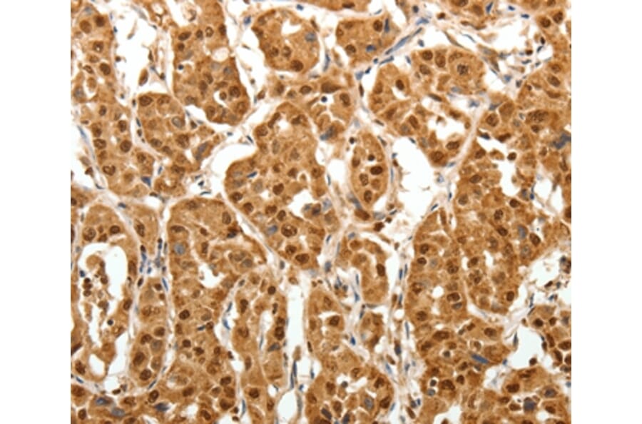 Immunohistochemistry - TNN Antibody from Signalway Antibody (37267) - Antibodies.com