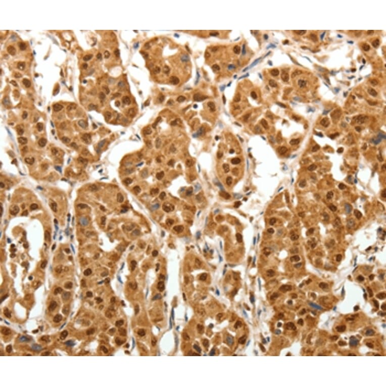 Immunohistochemistry - TNN Antibody from Signalway Antibody (37267) - Antibodies.com