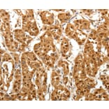 Immunohistochemistry - TNN Antibody from Signalway Antibody (37267) - Antibodies.com