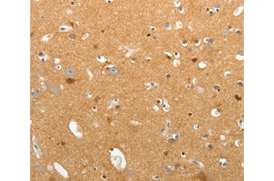 Immunohistochemistry - TNR Antibody from Signalway Antibody (37268) - Antibodies.com