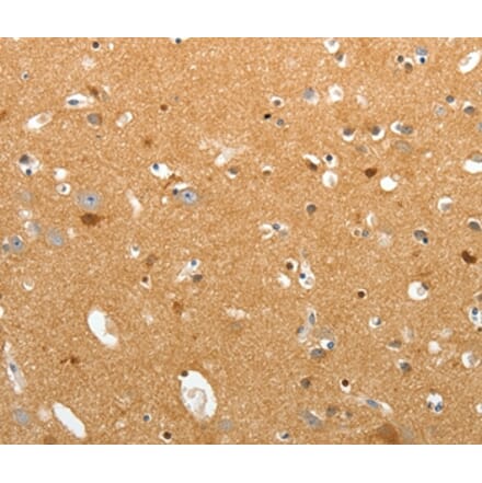 Immunohistochemistry - TNR Antibody from Signalway Antibody (37268) - Antibodies.com