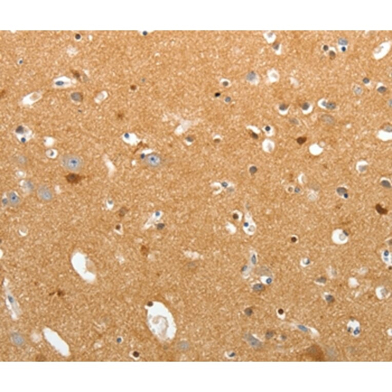 Immunohistochemistry - TNR Antibody from Signalway Antibody (37268) - Antibodies.com