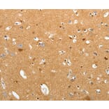 Immunohistochemistry - TNR Antibody from Signalway Antibody (37268) - Antibodies.com