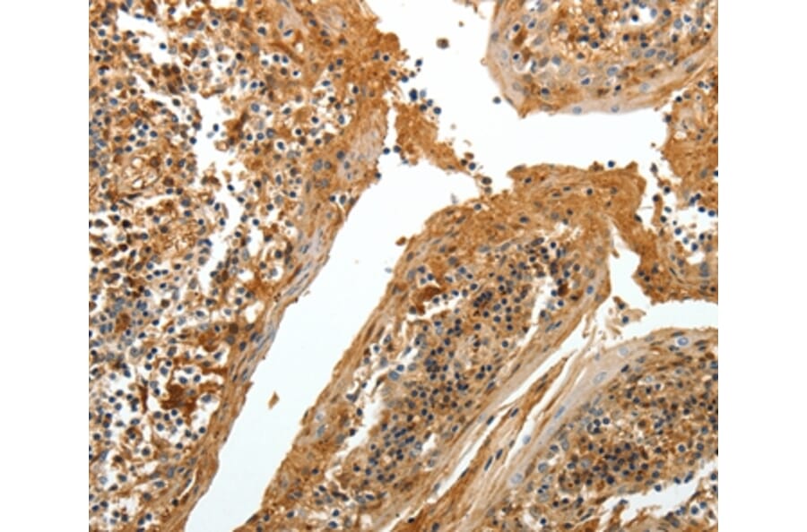 Immunohistochemistry - TNR Antibody from Signalway Antibody (37268) - Antibodies.com