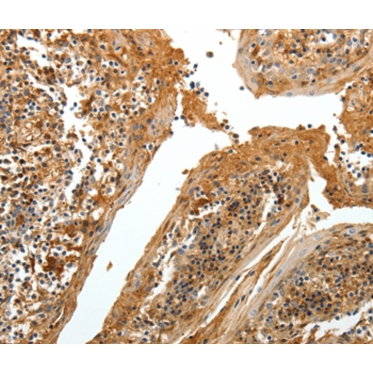 Immunohistochemistry - TNR Antibody from Signalway Antibody (37268) - Antibodies.com