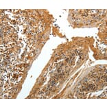 Immunohistochemistry - TNR Antibody from Signalway Antibody (37268) - Antibodies.com