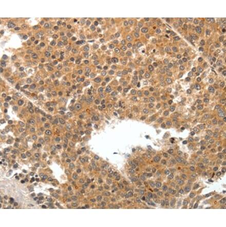 Immunohistochemistry - TEK Antibody from Signalway Antibody (37274) - Antibodies.com