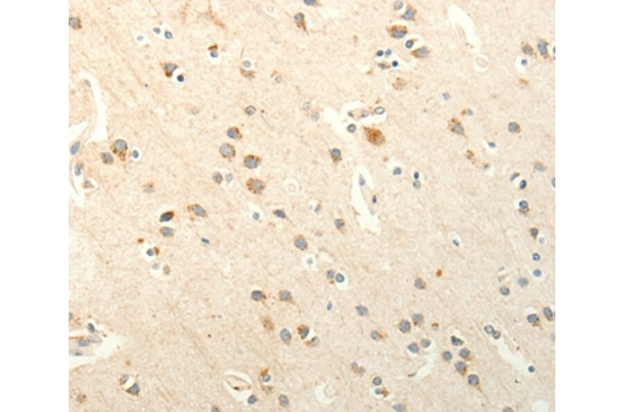 Immunohistochemistry - SMO Antibody from Signalway Antibody (37295) - Antibodies.com