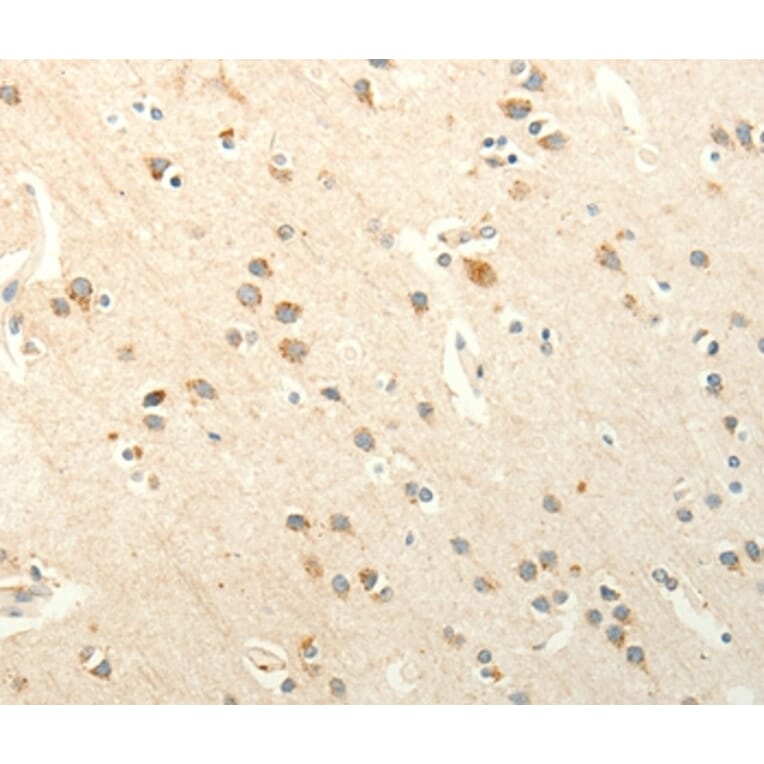 Immunohistochemistry - SMO Antibody from Signalway Antibody (37295) - Antibodies.com