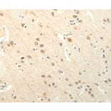 Immunohistochemistry - SMO Antibody from Signalway Antibody (37295) - Antibodies.com