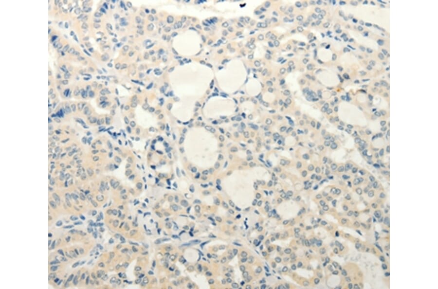 Immunohistochemistry - SMO Antibody from Signalway Antibody (37295) - Antibodies.com