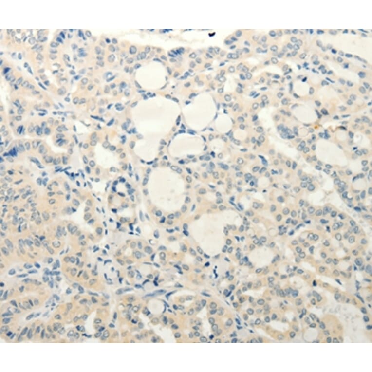 Immunohistochemistry - SMO Antibody from Signalway Antibody (37295) - Antibodies.com