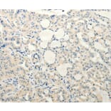 Immunohistochemistry - SMO Antibody from Signalway Antibody (37295) - Antibodies.com