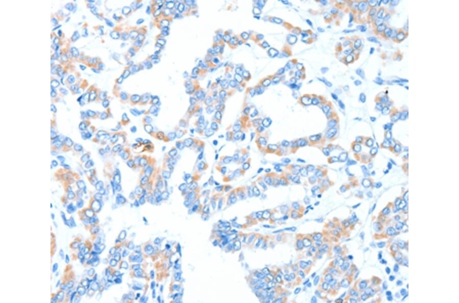 Immunohistochemistry - GPT Antibody from Signalway Antibody (37322) - Antibodies.com