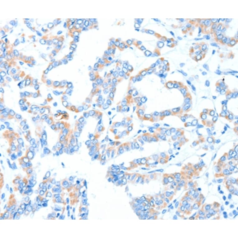 Immunohistochemistry - GPT Antibody from Signalway Antibody (37322) - Antibodies.com