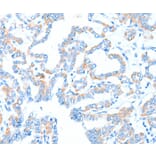 Immunohistochemistry - GPT Antibody from Signalway Antibody (37322) - Antibodies.com