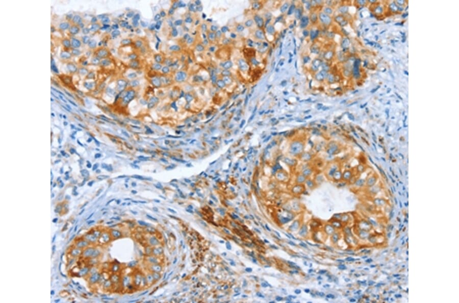 Immunohistochemistry - AIP Antibody from Signalway Antibody (37341) - Antibodies.com