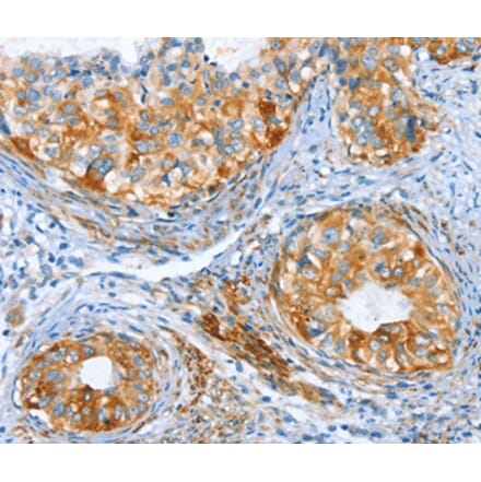 Immunohistochemistry - AIP Antibody from Signalway Antibody (37341) - Antibodies.com