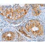 Immunohistochemistry - AIP Antibody from Signalway Antibody (37341) - Antibodies.com