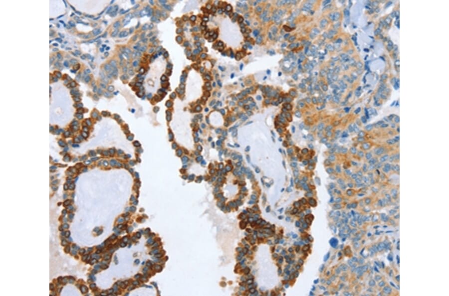 Immunohistochemistry - AIP Antibody from Signalway Antibody (37341) - Antibodies.com