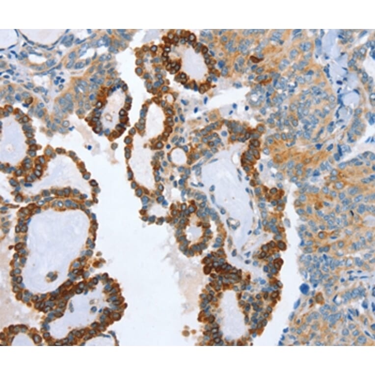 Immunohistochemistry - AIP Antibody from Signalway Antibody (37341) - Antibodies.com