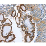Immunohistochemistry - AIP Antibody from Signalway Antibody (37341) - Antibodies.com