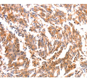 Immunohistochemistry - NES Antibody from Signalway Antibody (37358) - Antibodies.com