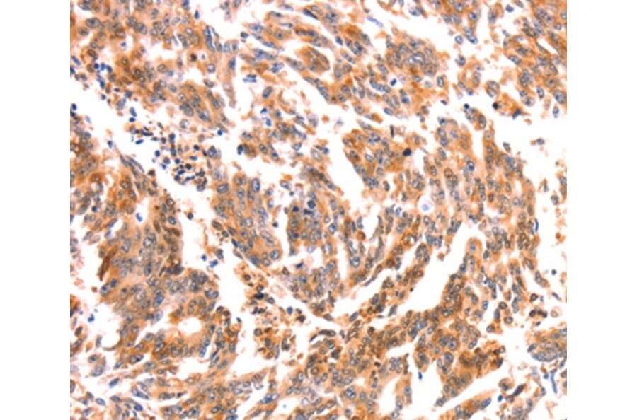 Immunohistochemistry - NES Antibody from Signalway Antibody (37358) - Antibodies.com