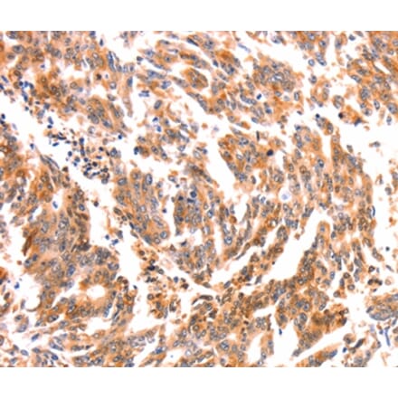 Immunohistochemistry - NES Antibody from Signalway Antibody (37358) - Antibodies.com