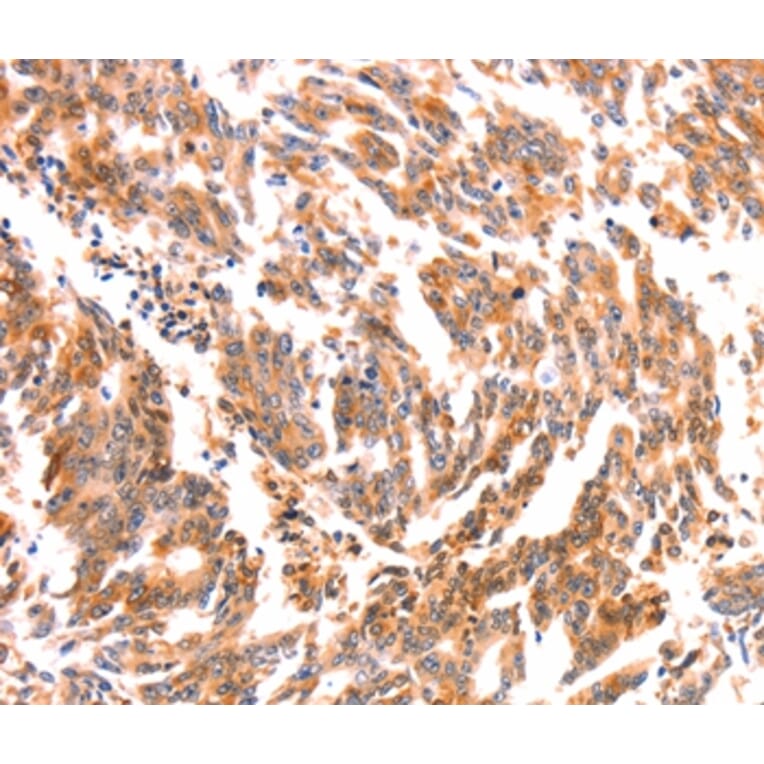 Immunohistochemistry - NES Antibody from Signalway Antibody (37358) - Antibodies.com