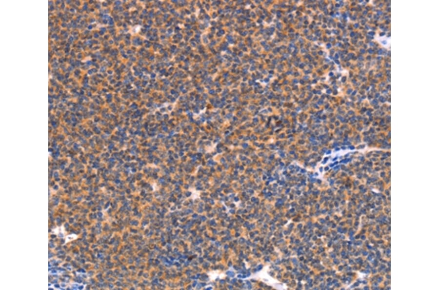 Immunohistochemistry - NES Antibody from Signalway Antibody (37358) - Antibodies.com