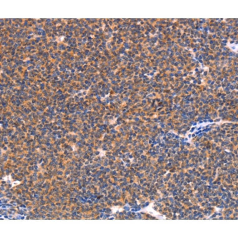 Immunohistochemistry - NES Antibody from Signalway Antibody (37358) - Antibodies.com