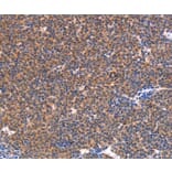 Immunohistochemistry - NES Antibody from Signalway Antibody (37358) - Antibodies.com