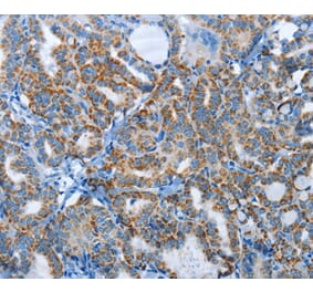 Immunohistochemistry - AGL Antibody from Signalway Antibody (37366) - Antibodies.com